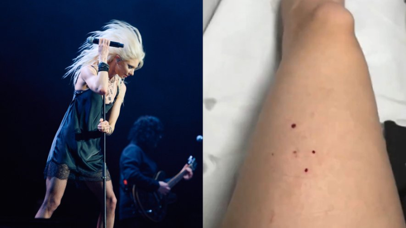 She was opening for AC/DC: singer Taylor Momsen gets her leg bitten by a bat during a concert