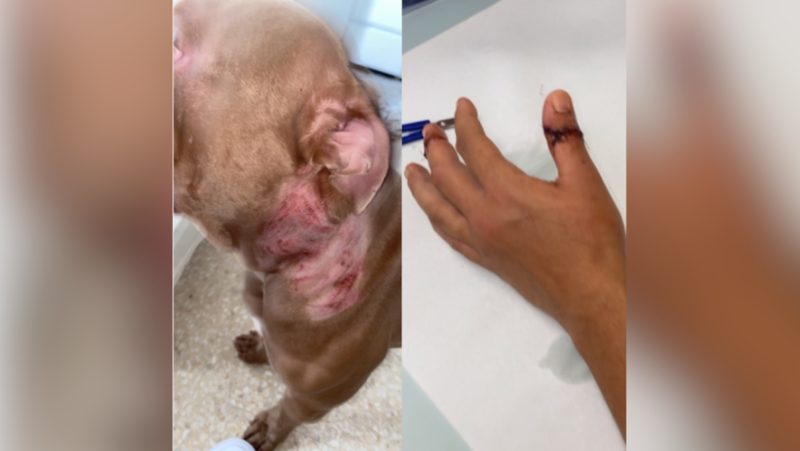 "He became violent and grabbed her by the throat": a Montpellier woman and her American bully attacked by two stray dogs